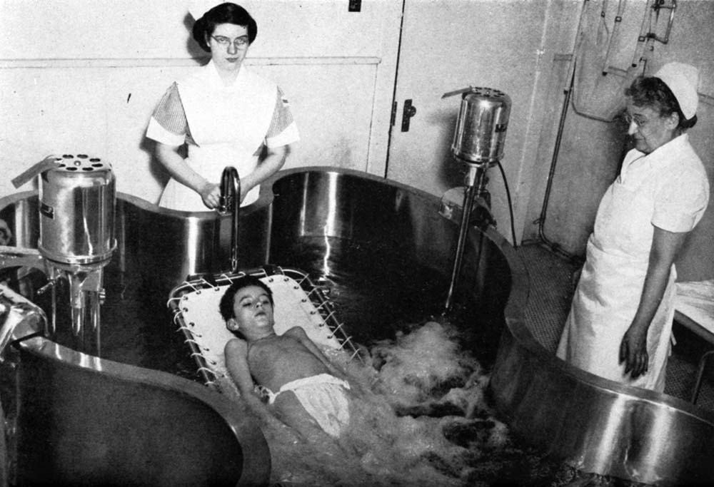 A Hubbard tank, used for warm-water hydrotherapy in the 1950s.